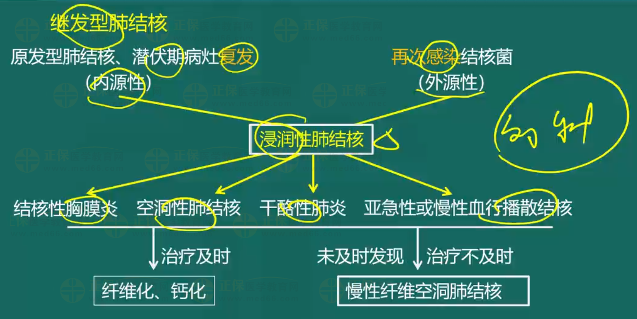 肺結(jié)核-3