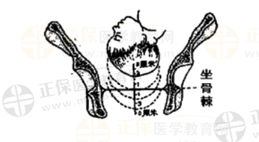 女性生殖系統考點速記